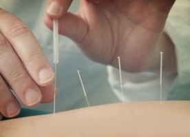 O milagre do tratamento com acupuntura para dores e doenas