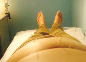 Tratamento de acupuntura para obesidade e intestino preso